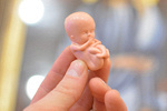 Риски беременности после аборта фото